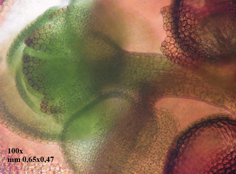 Calypogeia muelleriana?